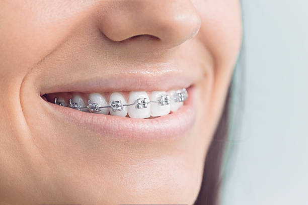 Trusted Four Corners, MD Dental Services Experts